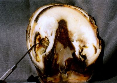 normal D11A jpg